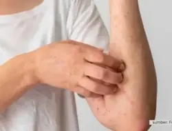 Kasus Sifilis di Kalangan Gen Z Melonjak, DPR Desak Langkah Nyata Pemerintah